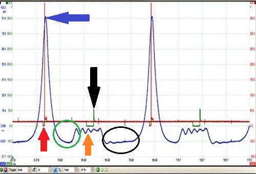 In-cylinder pressure trace